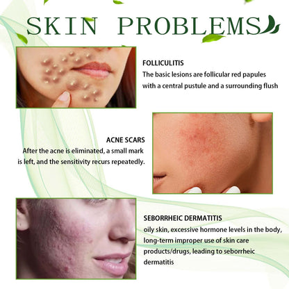 Cream Skin Repair Clean Acne Care